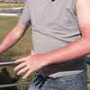 Ease sunburns and bug bites