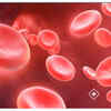 Anemia