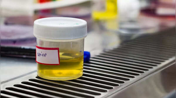 Blood in urine