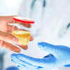Changes in urine
