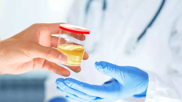 Changes in urine