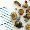 What is a kidney stone?