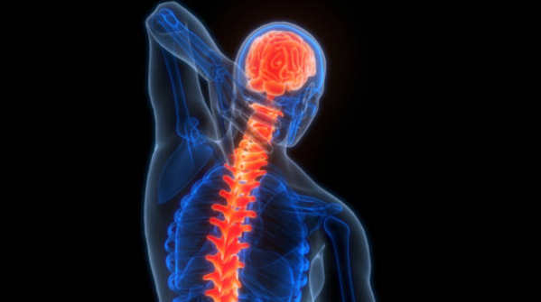Types of paralysis