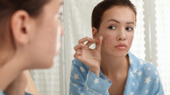 Treating and spot healing