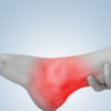 Puffiness in the ankles that comes and goes