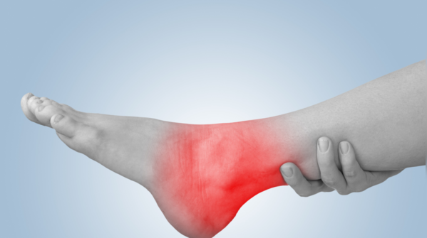 Puffiness in the ankles that comes and goes