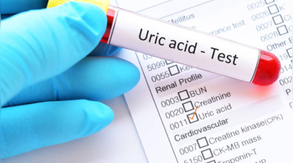 What is uric acid?