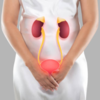 Why do uric acid levels increase?