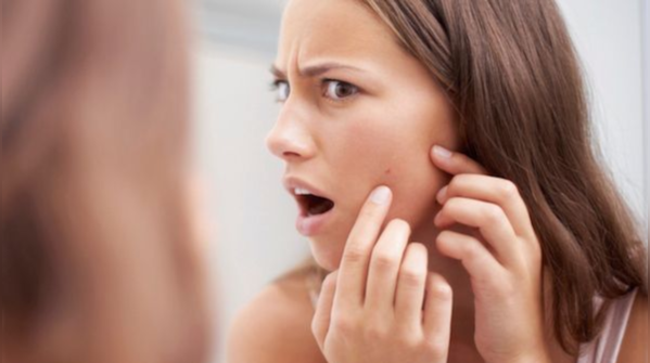 Avoid these daily habits to get rid of clogged pores and acne