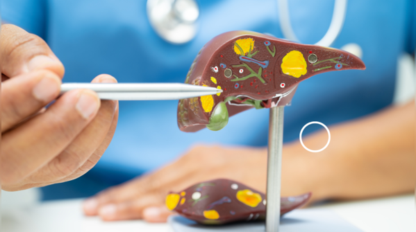 How to reverse the damage done to the liver?