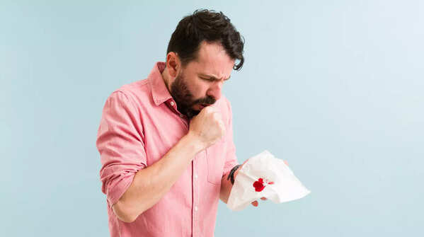 What are the symptoms