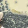 Is Aspergillosis dangerous