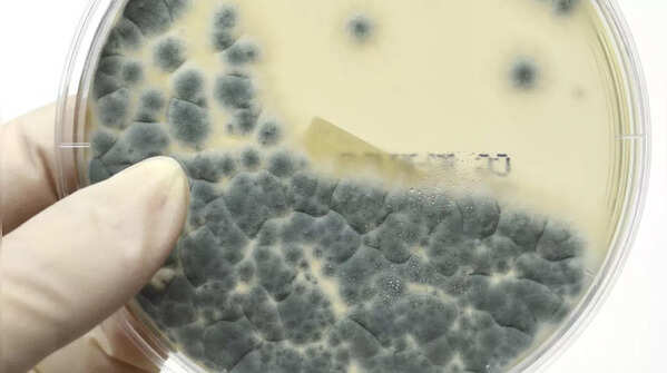 Is Aspergillosis dangerous
