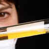 Track your urine colour