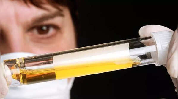Track your urine colour