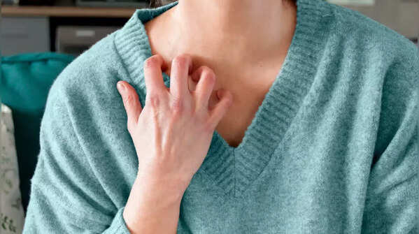 Persistent itching or rash