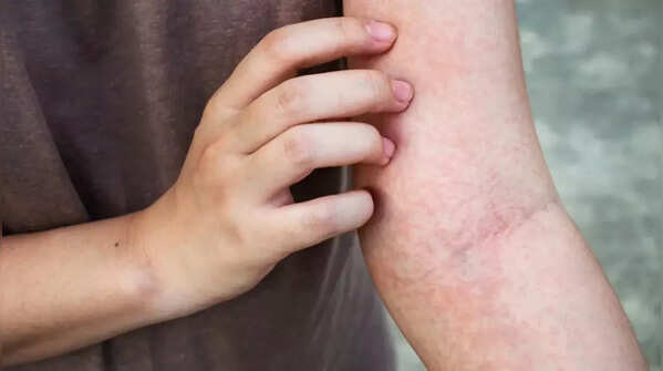 Persistent itchy or painful skin