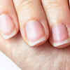 Changes in nail appearance
