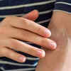 Persistent dry or crusty patches