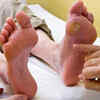 Non-healing sores or ulcers