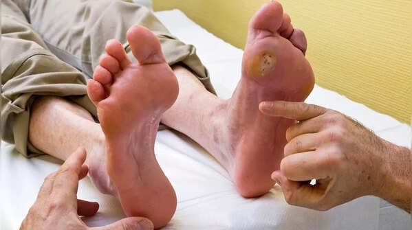 Non-healing sores or ulcers