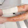 Skin that doesn't heal properly