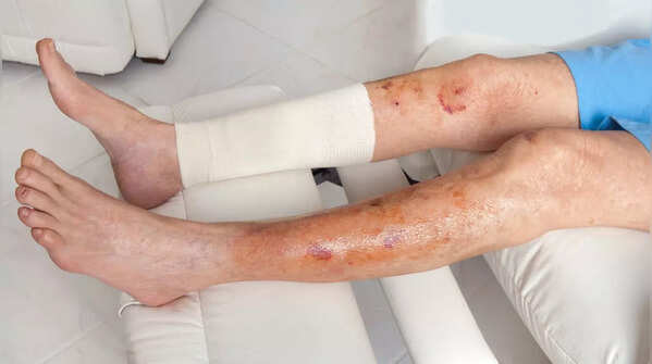 Skin that doesn't heal properly