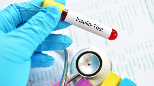 Fasting insulin test