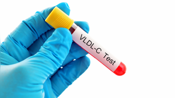 Lipoprotein(a) test