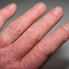 Your hands and legs might know before you do