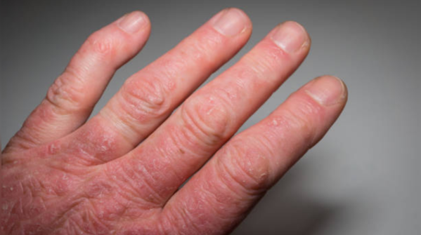 Your hands and legs might know before you do