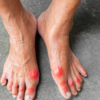 Hard lumps or nodules under the skin