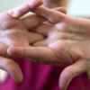 Sudden joint stiffness in knees and elbows