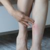 Unusual swelling and redness