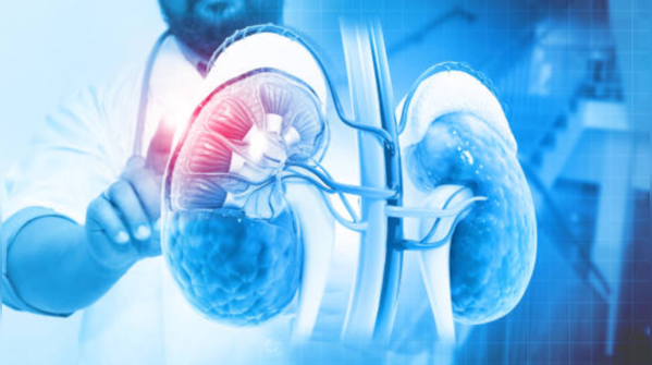 Kidney cancer cases are increasing