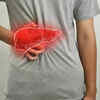 Signs of fatty liver