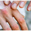 Sudden changes to skin texture
