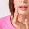  Sores that do not heal