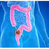 Rapid weight loss