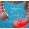 Abdominal Discomfort or Pain
