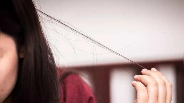 Symptoms of trichotillomania