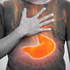 Consuming yogurt during acid reflux or hyperacidity