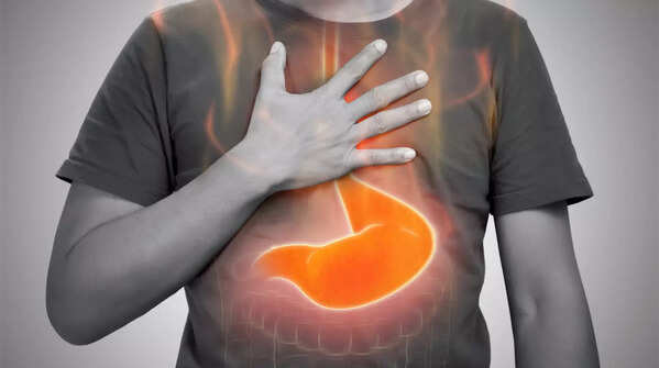 Consuming yogurt during acid reflux or hyperacidity