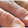 Spoon Nails