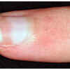 Pale or White Nails
