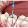 Poor oral health can lead to heart disease