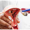 Pain During Sexual Intercourse