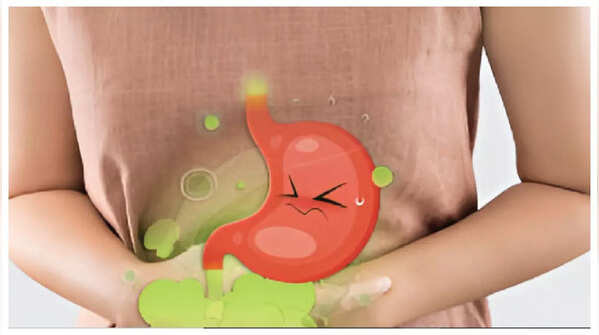 5 Foods that can prevent Stomach Cancer