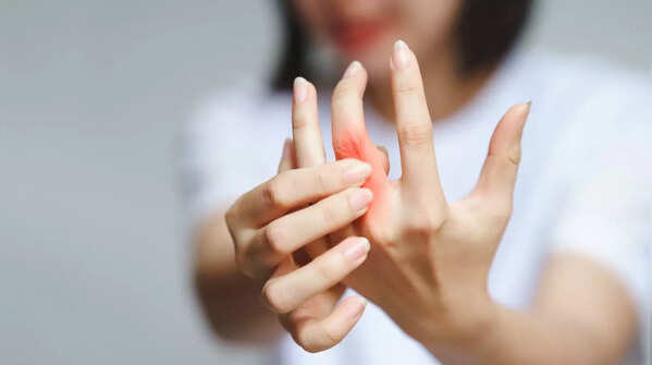 Autoimmune diseases