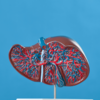 Fat in the liver isn’t always benign